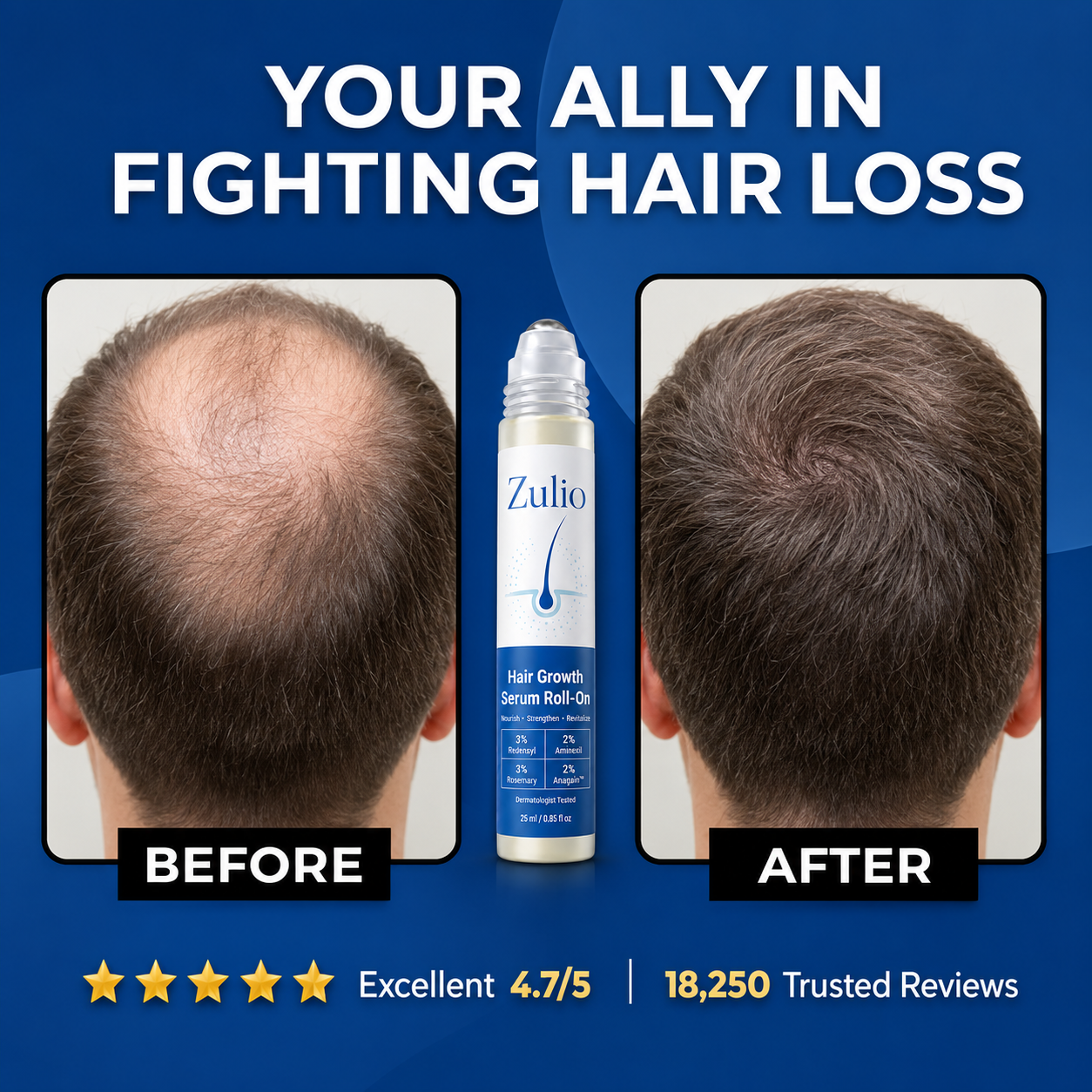 Zulio Advanced Hair Growth Serum